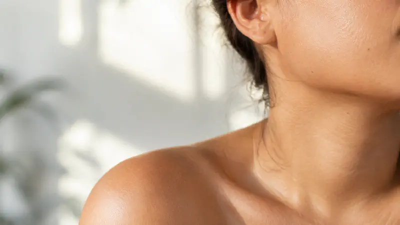 Acne Scarring: Types and What Actually Fades Them