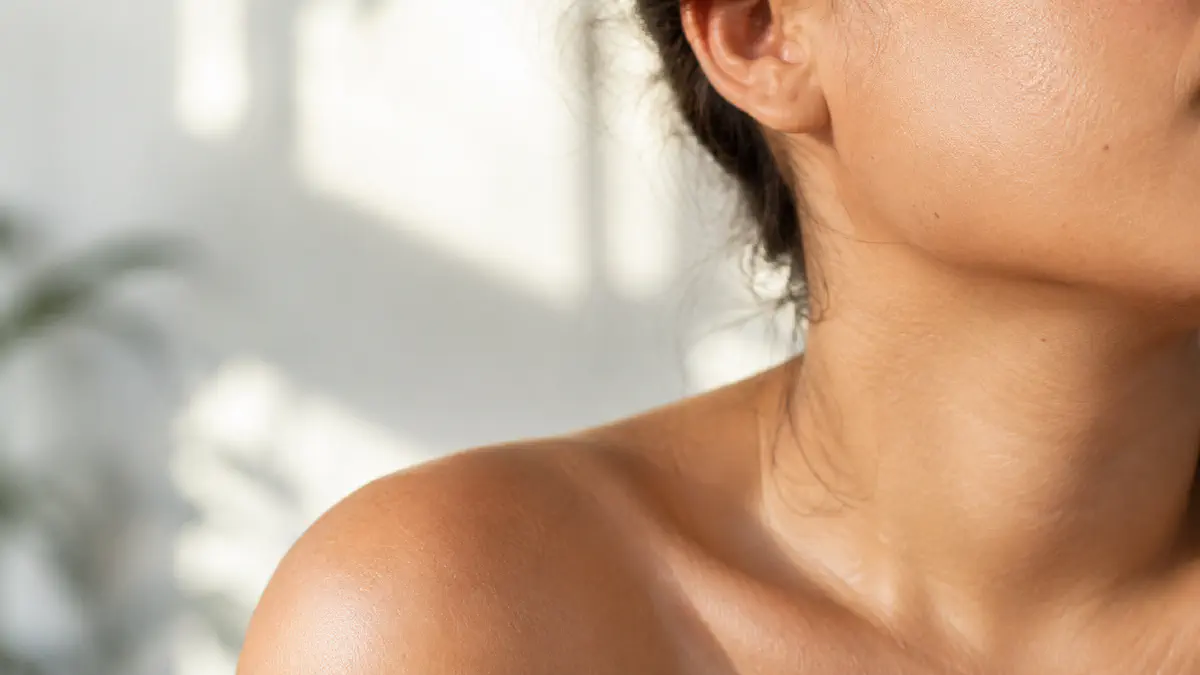 Different types of post-acne marks and scarring